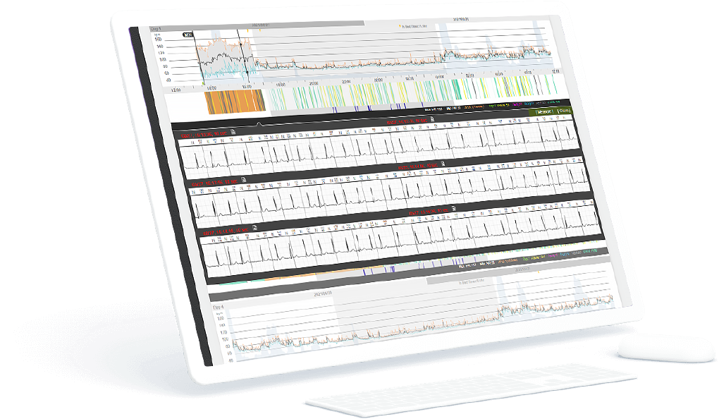 Relecture ECG en ligne RootiCare