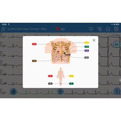 electrocardiographe-edan-se-1200-pro4.webp