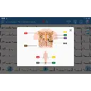 electrocardiographe-edan-se-1200-pro4.webp